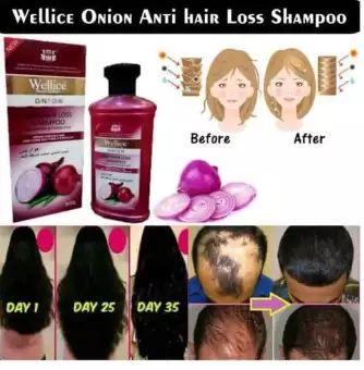 Wellice Onion Shampoo-Wellice Professional anti Hair Fall Shampoo - Image 3