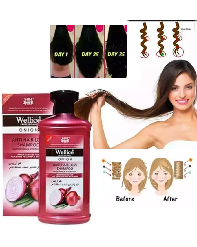 Wellice Onion Shampoo-Wellice Professional anti Hair Fall Shampoo - Image 5